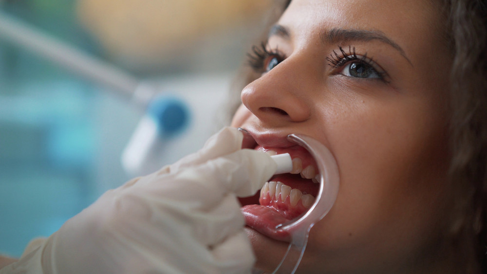 Dentist holding teeth whitening options next to patient’s teeth during whitening consultation.
